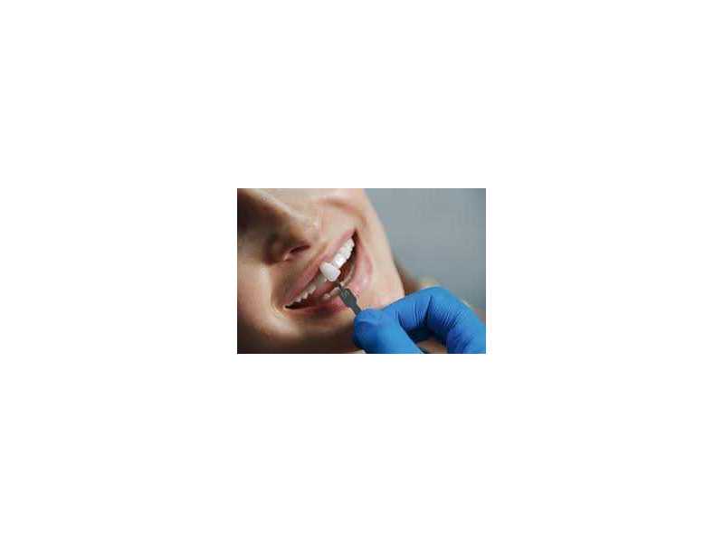 transform-your-smile-at-the-best-dental-implant-clinic-in-chetla-small-0