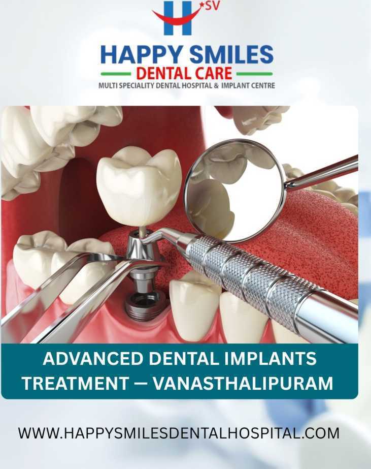 advanced-dental-implants-treatment-vanasthalipuram-clinic-big-0