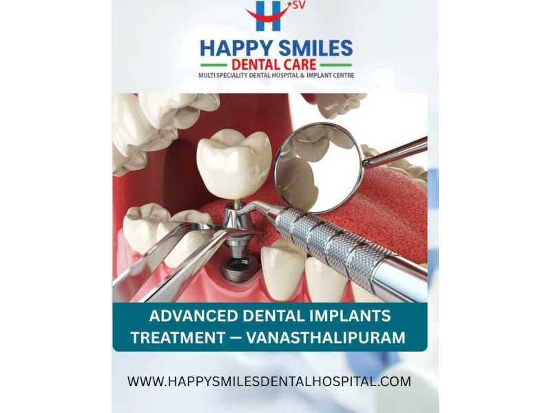 advanced-dental-implants-treatment-vanasthalipuram-clinic-small-0