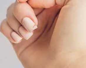homeopathy-medicine-for-brittle-nails