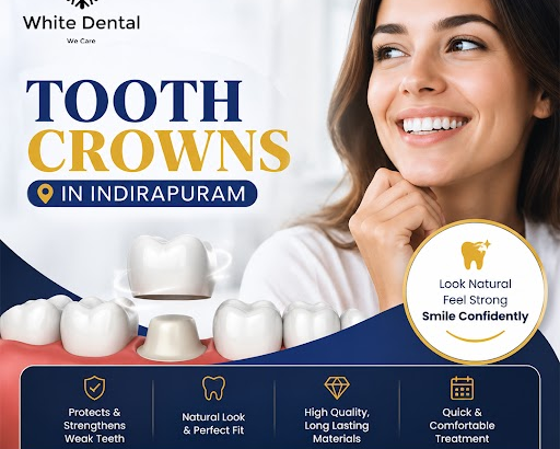 tooth-crowns-in-indirapuram-for-restoring-damaged-teeth