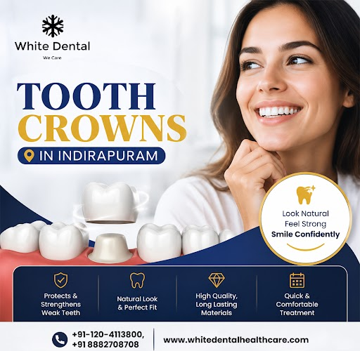 tooth-crowns-in-indirapuram-for-restoring-damaged-teeth-big-0