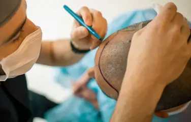 y-cell-prp-treatment-for-hair-loss-acne-scars-pigmentation-big-0
