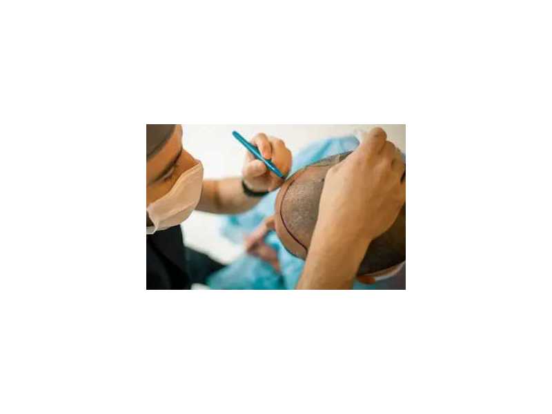 y-cell-prp-treatment-for-hair-loss-acne-scars-pigmentation-small-0