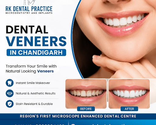 dental-veneers-in-chandigarh-for-cosmetic-smile-enhancement