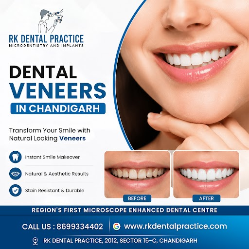 dental-veneers-in-chandigarh-for-cosmetic-smile-enhancement-big-0