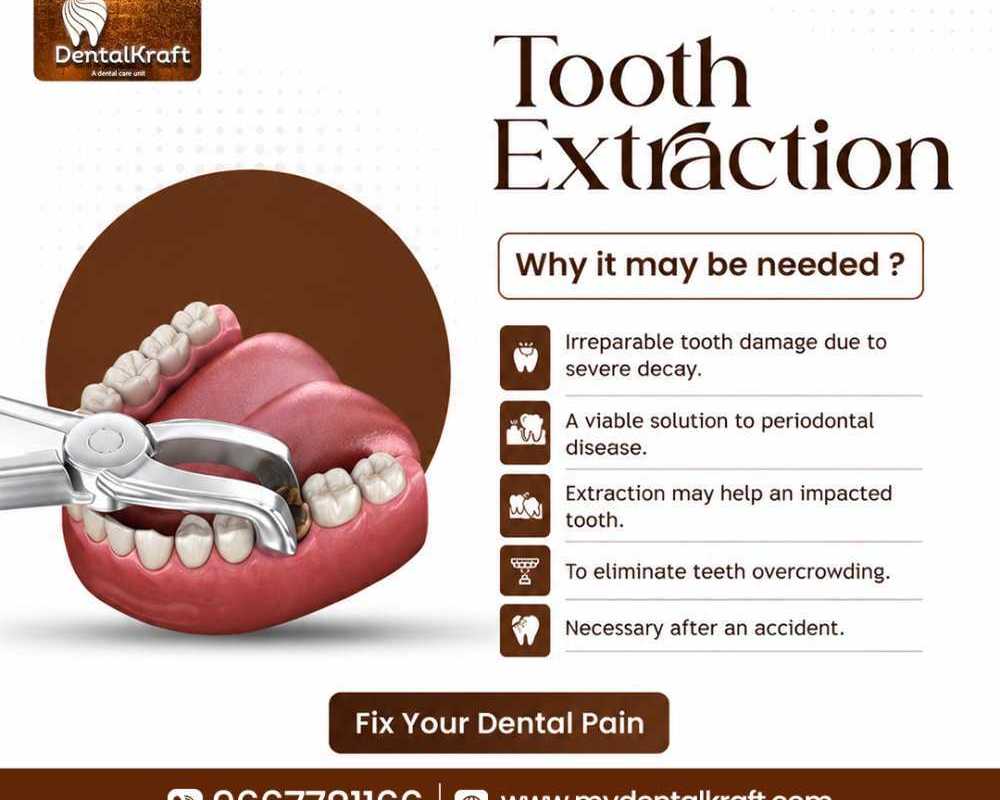 best-dentist-for-tooth-extraction-in-indirapuram-for-safe