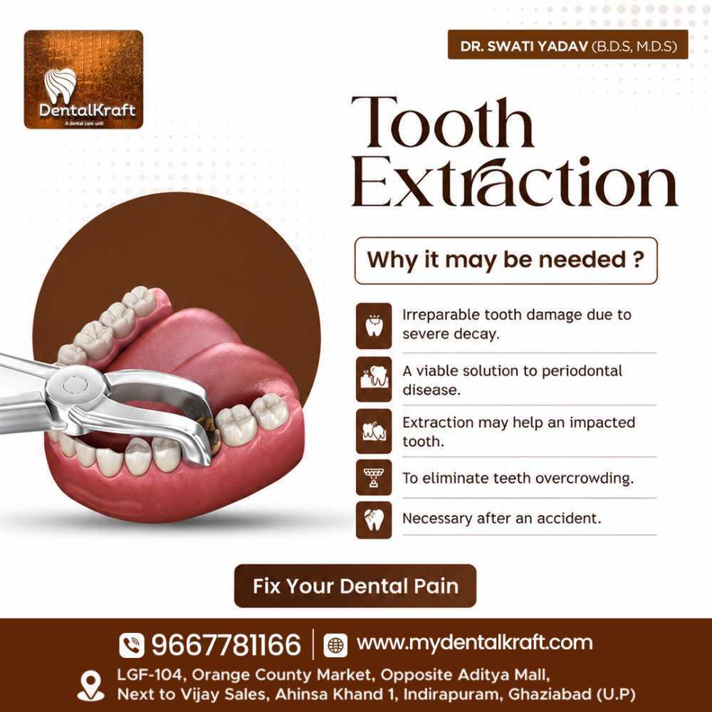 best-dentist-for-tooth-extraction-in-indirapuram-for-safe-big-0