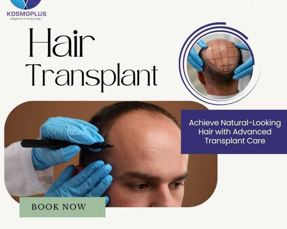 say-goodbye-to-bald-patches-with-hair-transplant-in-ahmedabad