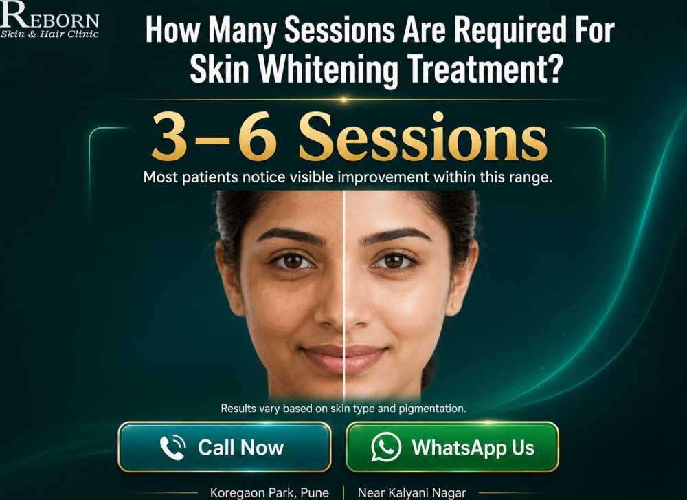 how-many-sessions-for-skin-whitening-treatment-in-koregaon-park-big-0