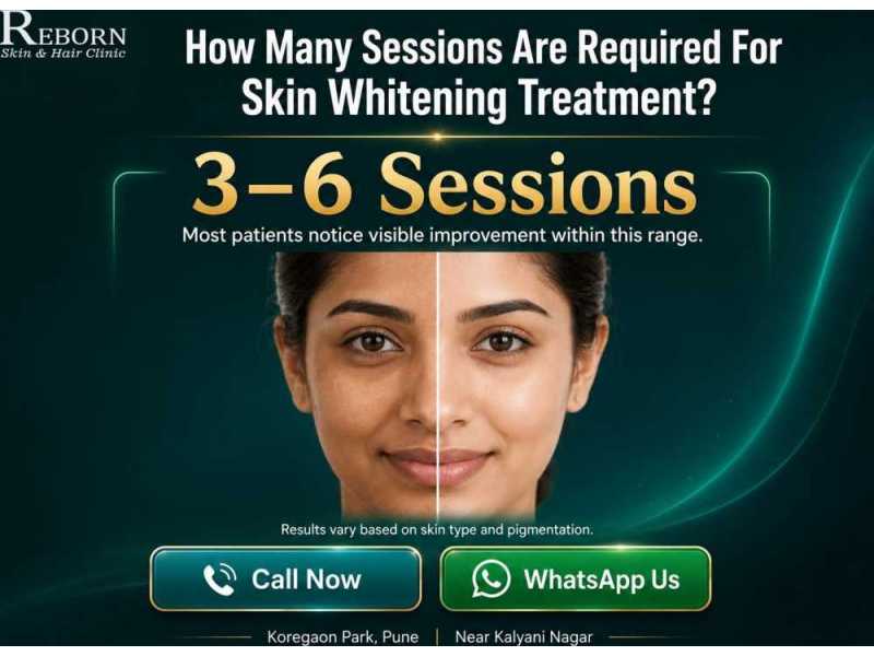 how-many-sessions-for-skin-whitening-treatment-in-koregaon-park-small-0