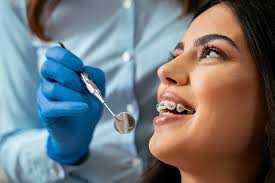 achieve-a-perfect-smile-with-the-best-dental-brace-in-chetla-big-0
