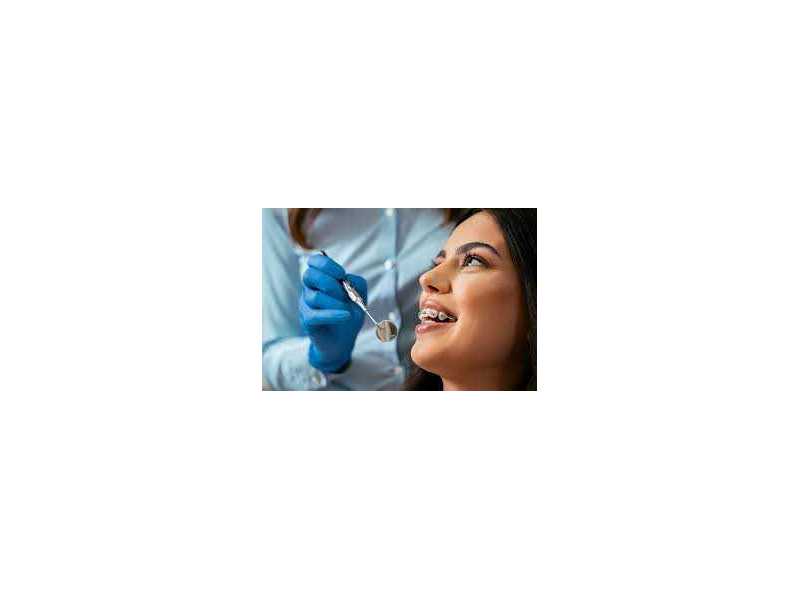 achieve-a-perfect-smile-with-the-best-dental-brace-in-chetla-small-0