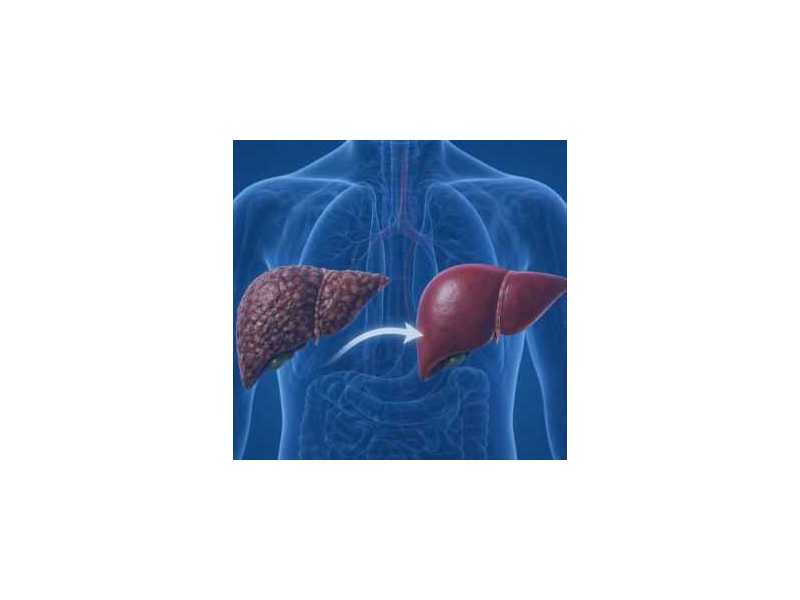 hire-liver-replacement-surgery-india-experts-at-medtreeva-small-0