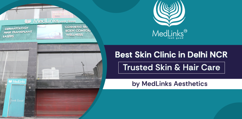 why-medlinks-is-considered-one-of-the-best-skin-clinics-in-delhi-ncr-big-0