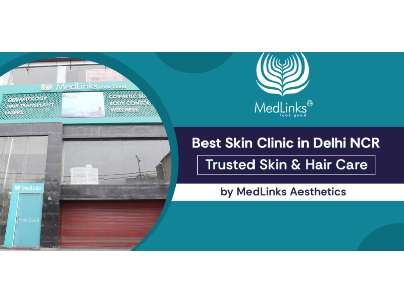 why-medlinks-is-considered-one-of-the-best-skin-clinics-in-delhi-ncr-small-0