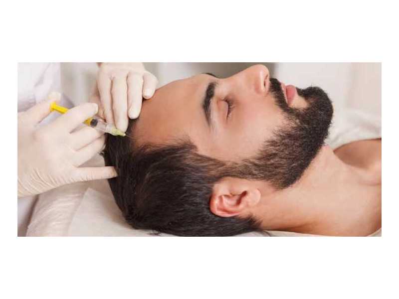 gfc-hair-treatment-for-hair-regrowth-estique-clinic-small-0