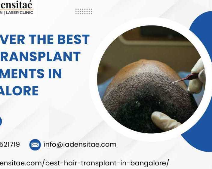 discover-the-best-hair-transplant-treatments-in-bangalore