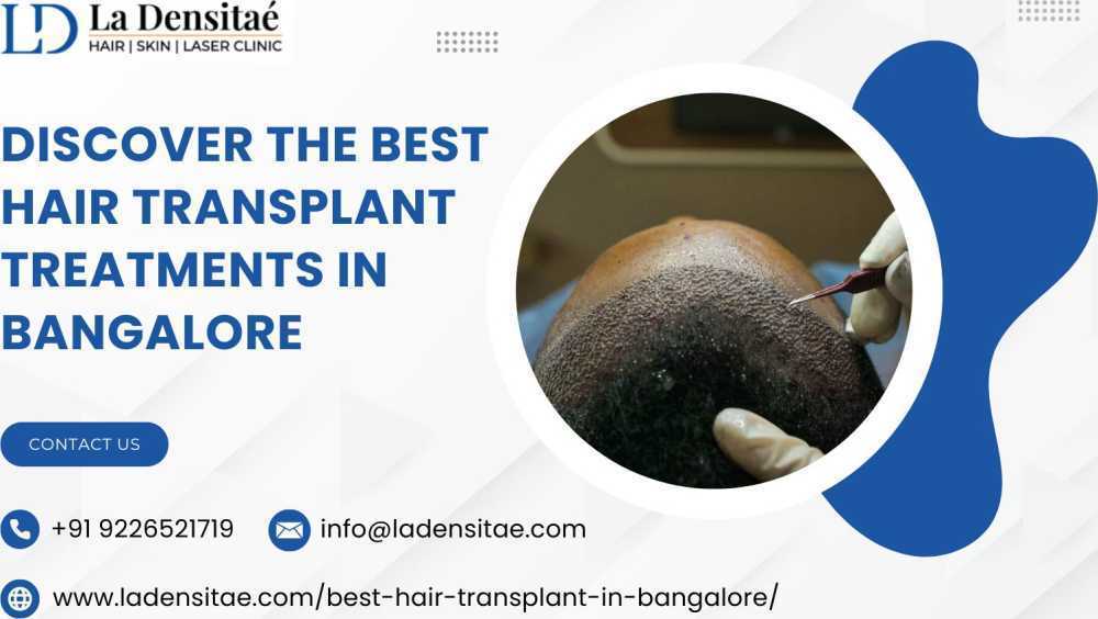 discover-the-best-hair-transplant-treatments-in-bangalore-big-0