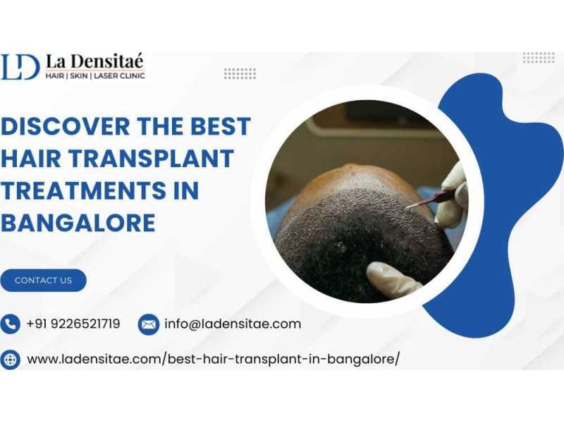 discover-the-best-hair-transplant-treatments-in-bangalore-small-0