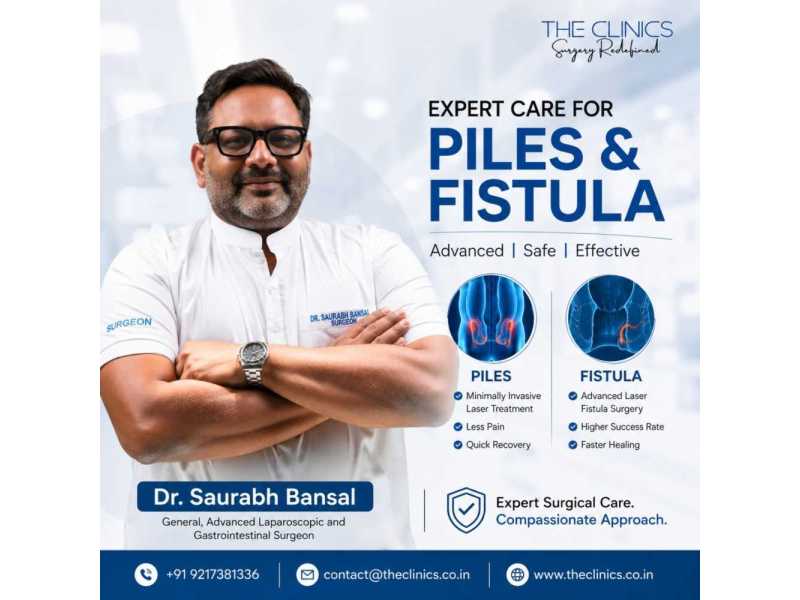 best-piles-surgery-in-india-advanced-laser-minimally-invasive-treatment-small-0