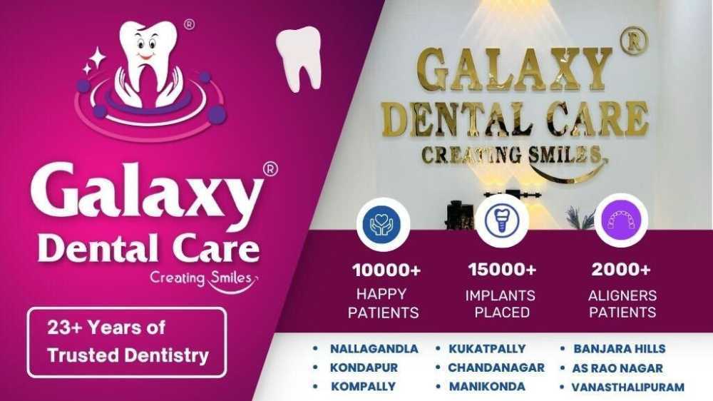galaxy-dental-care-best-dental-clinic-in-kukatpally-big-1