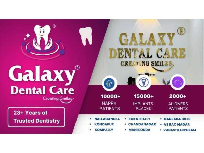 galaxy-dental-care-best-dental-clinic-in-as-rao-nagar-small-1