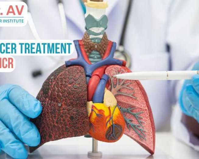 comprehensive-lung-cancer-treatment-in-delhi-ncr-for-better-care