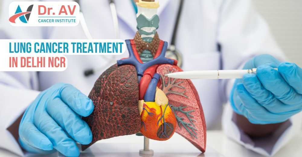 comprehensive-lung-cancer-treatment-in-delhi-ncr-for-better-care-big-0