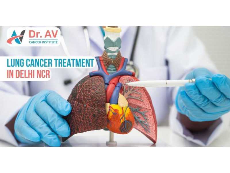 comprehensive-lung-cancer-treatment-in-delhi-ncr-for-better-care-small-0