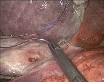 advanced-gastrointestinal-tumor-treatment-by-experienced-specialists-big-0