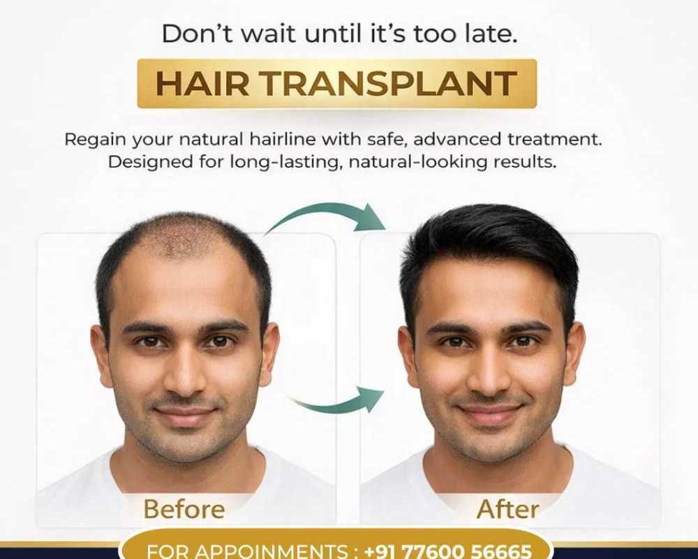 best-hair-transplant-clinic-in-electronic-city