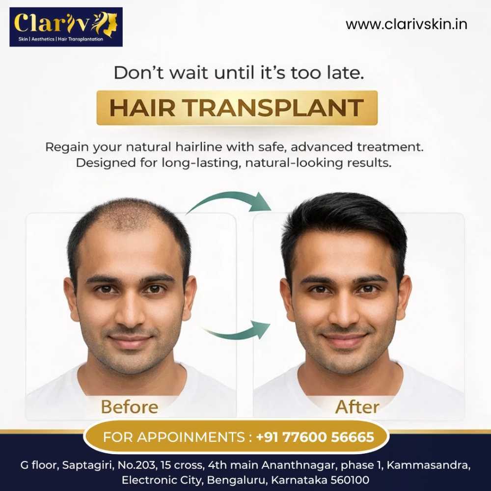 best-hair-transplant-clinic-in-electronic-city-big-0