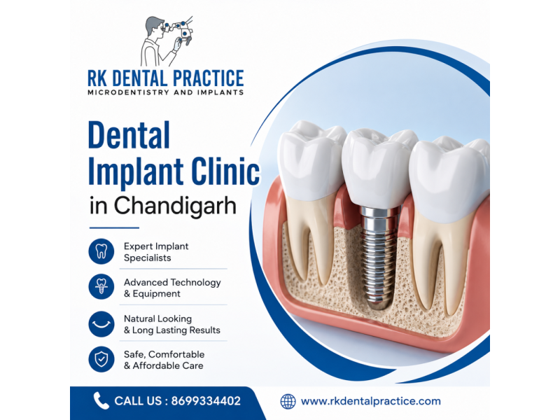 dental-implant-clinic-in-chandigarh-for-advanced-tooth-replacement-small-0