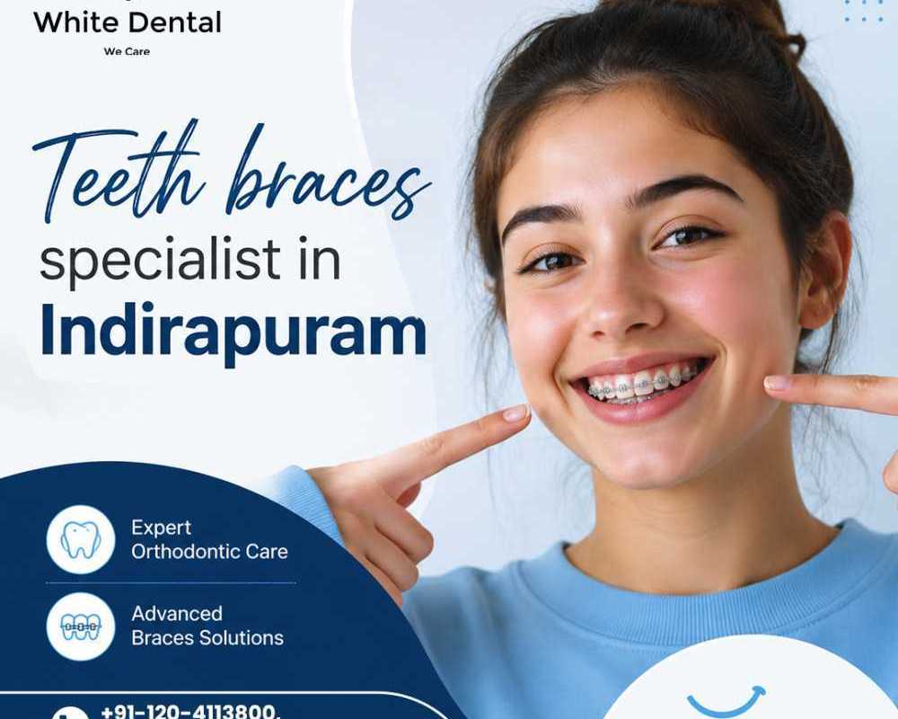 teeth-braces-specialist-in-indirapuram-for-better-smile-alignment