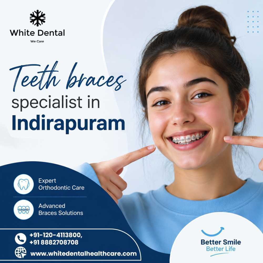 teeth-braces-specialist-in-indirapuram-for-better-smile-alignment-big-0