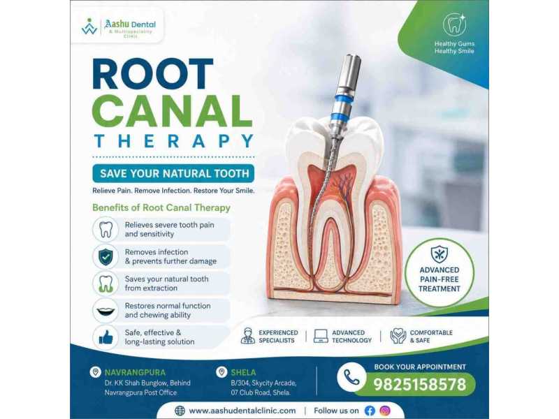 get-rid-of-tooth-pain-with-expert-root-canal-therapy-small-0
