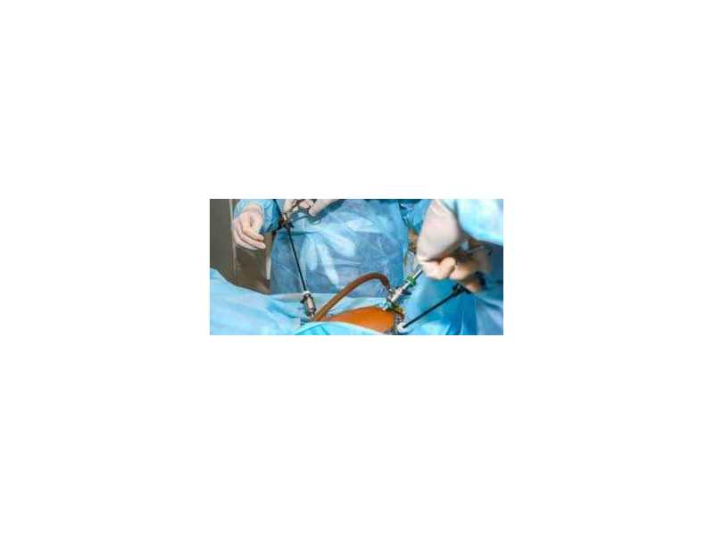 hospital-for-laparoscopic-surgery-in-kolkata-small-0
