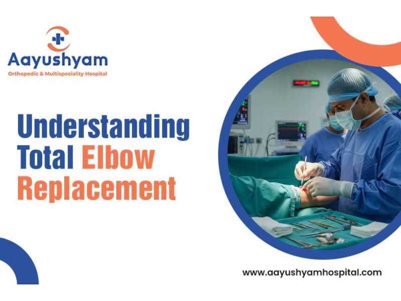 total-elbow-replacement-clear-guide-for-patients-small-0
