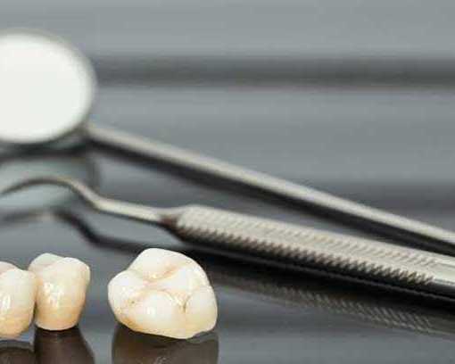 dental-crown-bridge-treatment-doctors-in-coimbatore