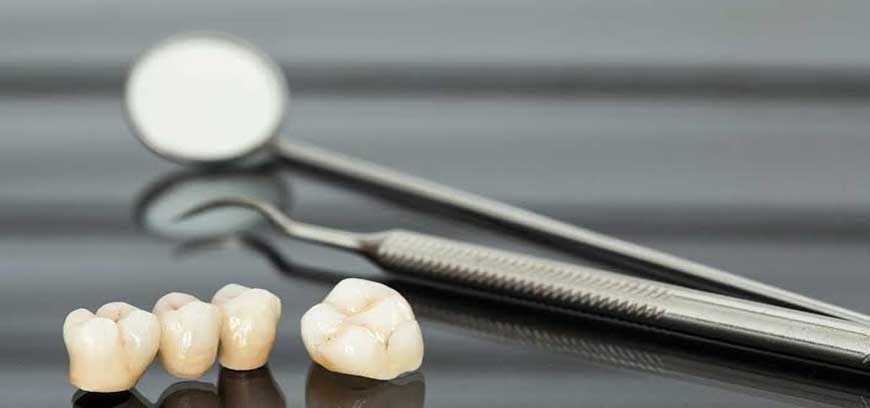 dental-crown-bridge-treatment-doctors-in-coimbatore-big-0
