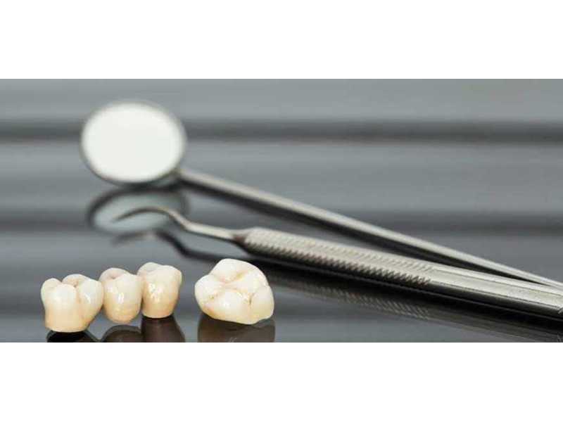 dental-crown-bridge-treatment-doctors-in-coimbatore-small-0