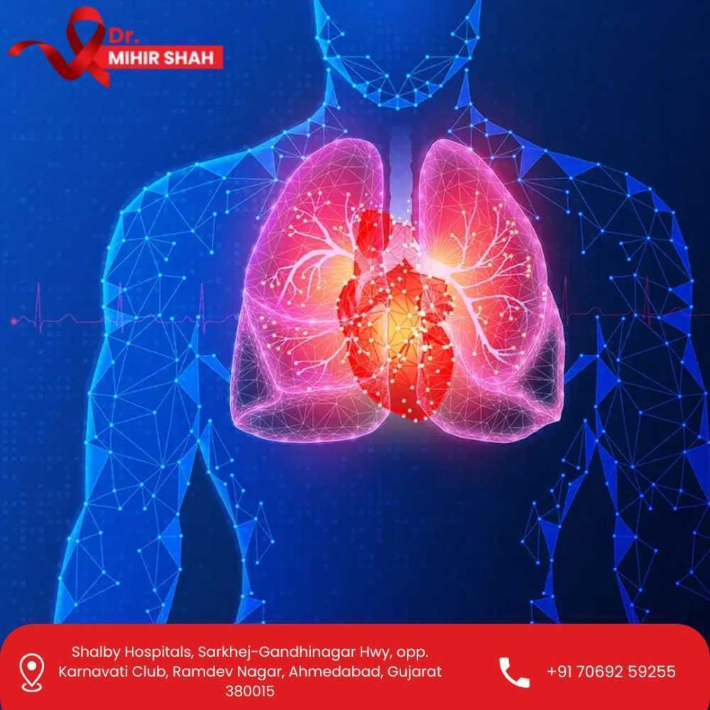 early-detection-and-best-lung-cancer-treatment-in-ahmedabad-dr-mihir-shah-big-0