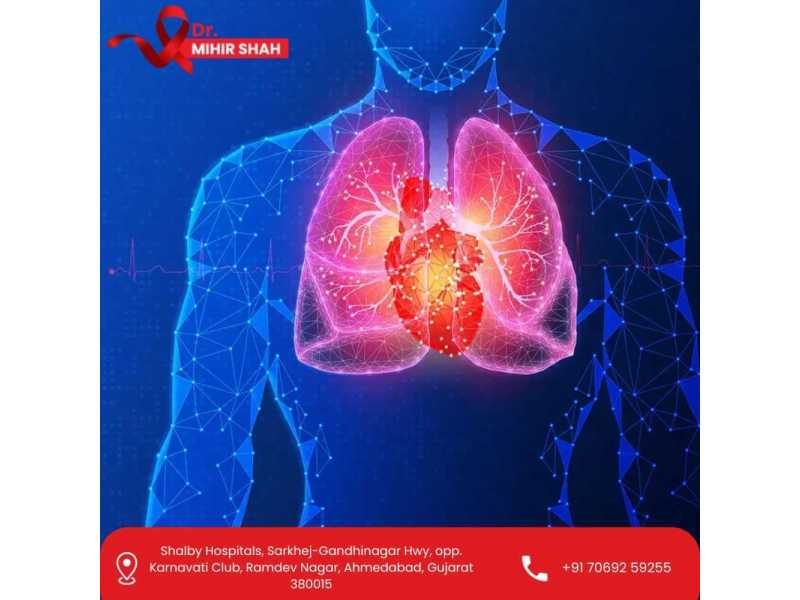 early-detection-and-best-lung-cancer-treatment-in-ahmedabad-dr-mihir-shah-small-0