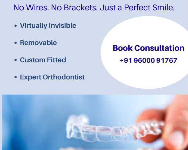 invisible-aligners-in-chennai
