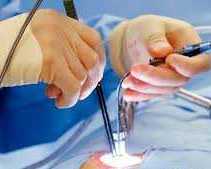 fast-relief-starts-with-the-best-laser-proctologist-in-dum-dum-park