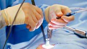 fast-relief-starts-with-the-best-laser-proctologist-in-dum-dum-park-big-0