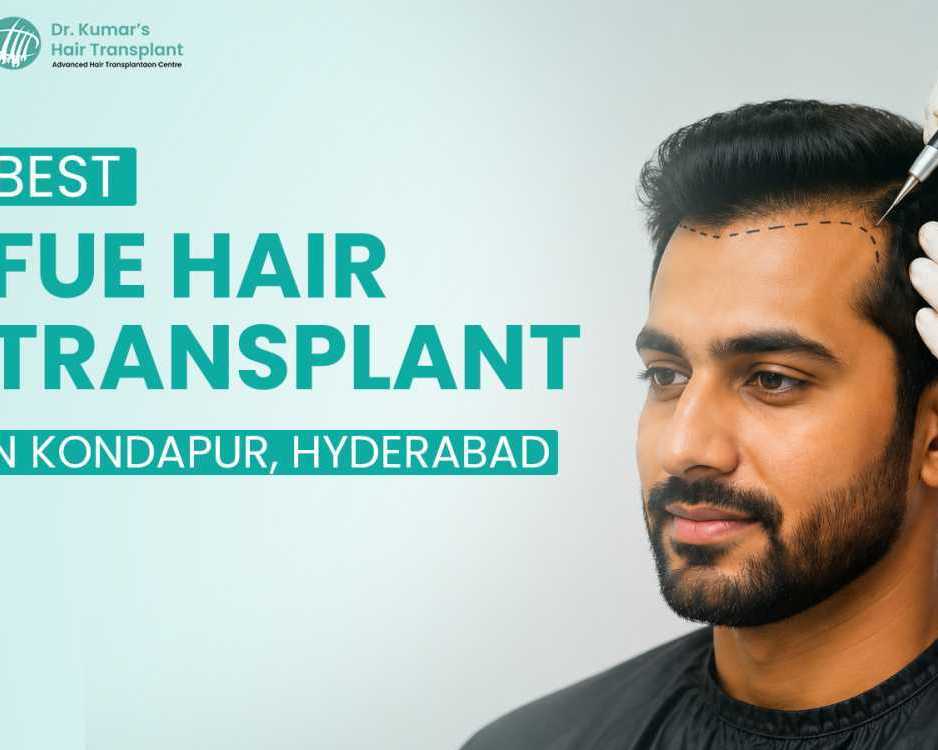 fue-hair-transplant-in-hyderabad-with-advanced-techniques