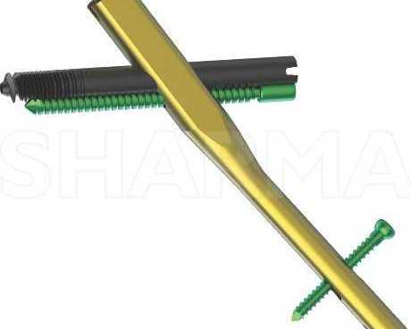 reliable-interlocking-nail-systems-for-strong-fracture-stabilization