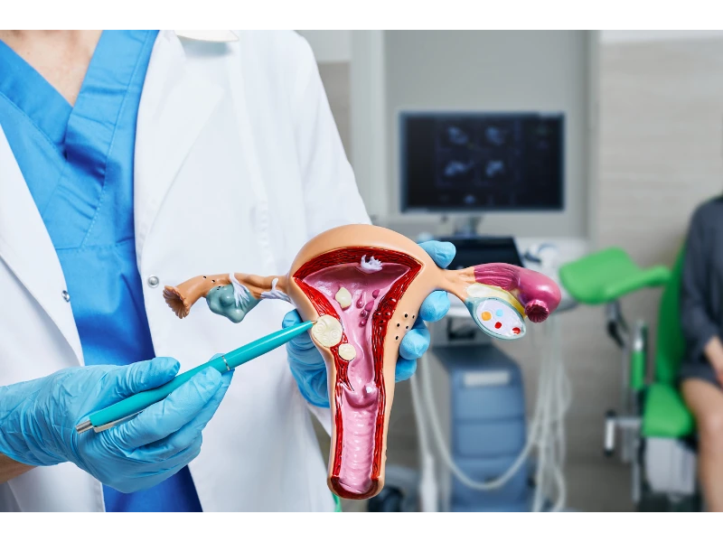 uterine-fibroids-symptoms-what-causes-fibroids-small-0